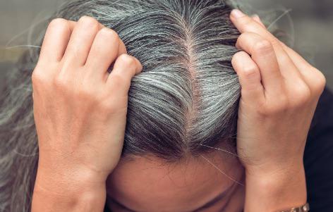 Pourquoi le stress donne des cheveux blancs ?